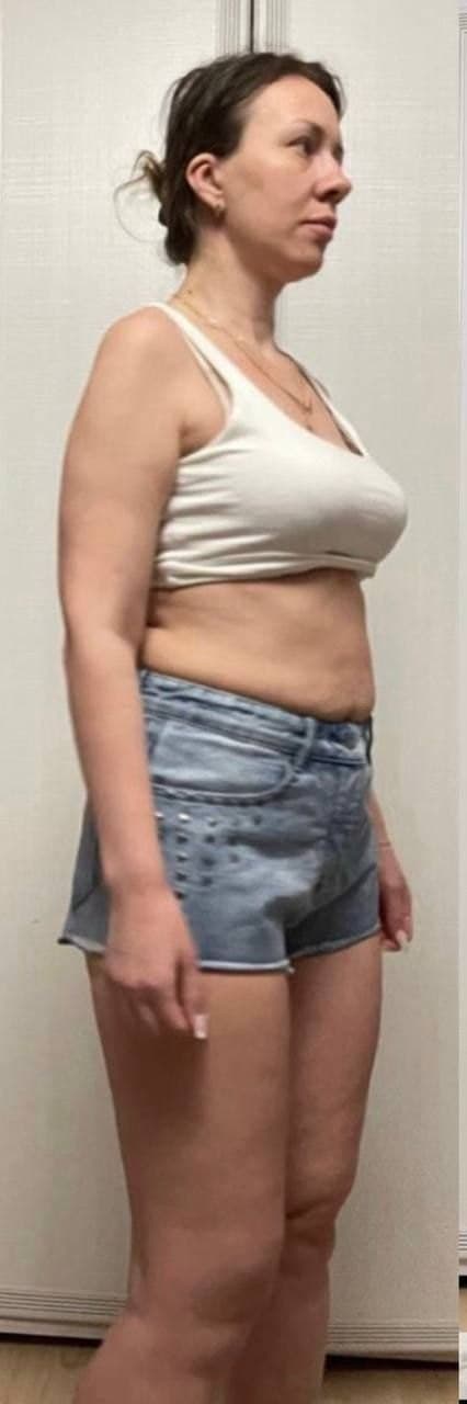 Before — transformation 3