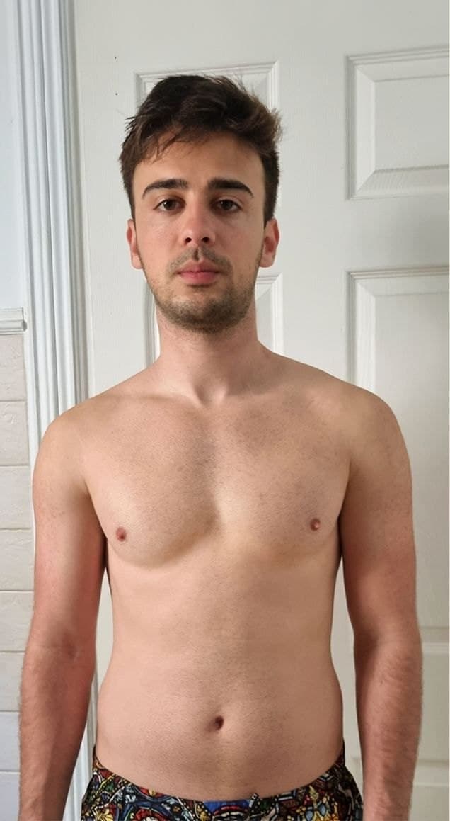 Before — transformation 4