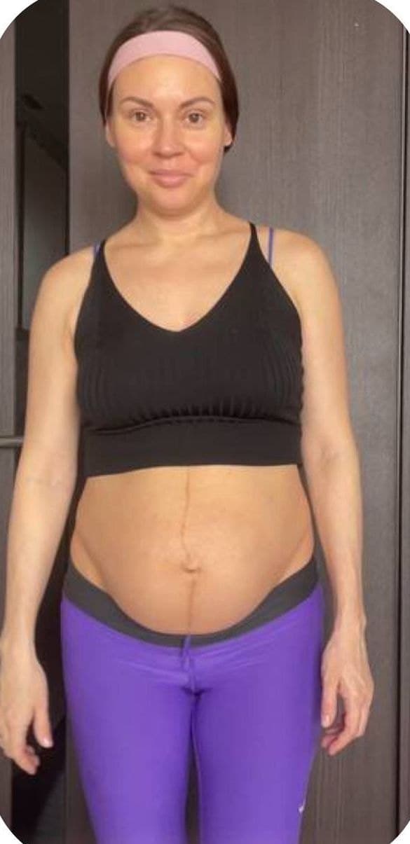 Before — transformation 5