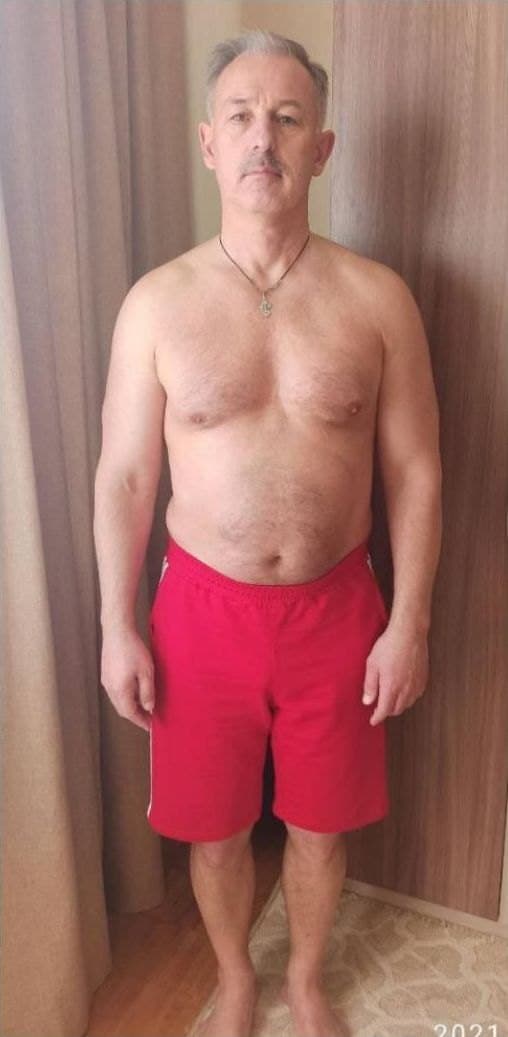 Before — transformation 7