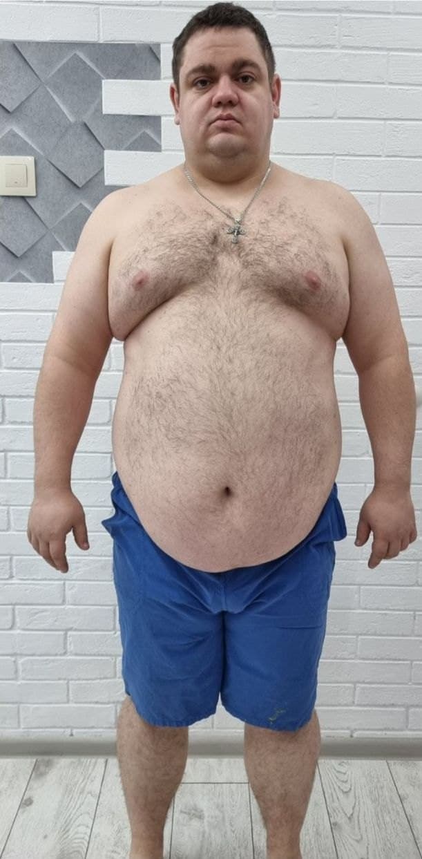 Before — transformation 8